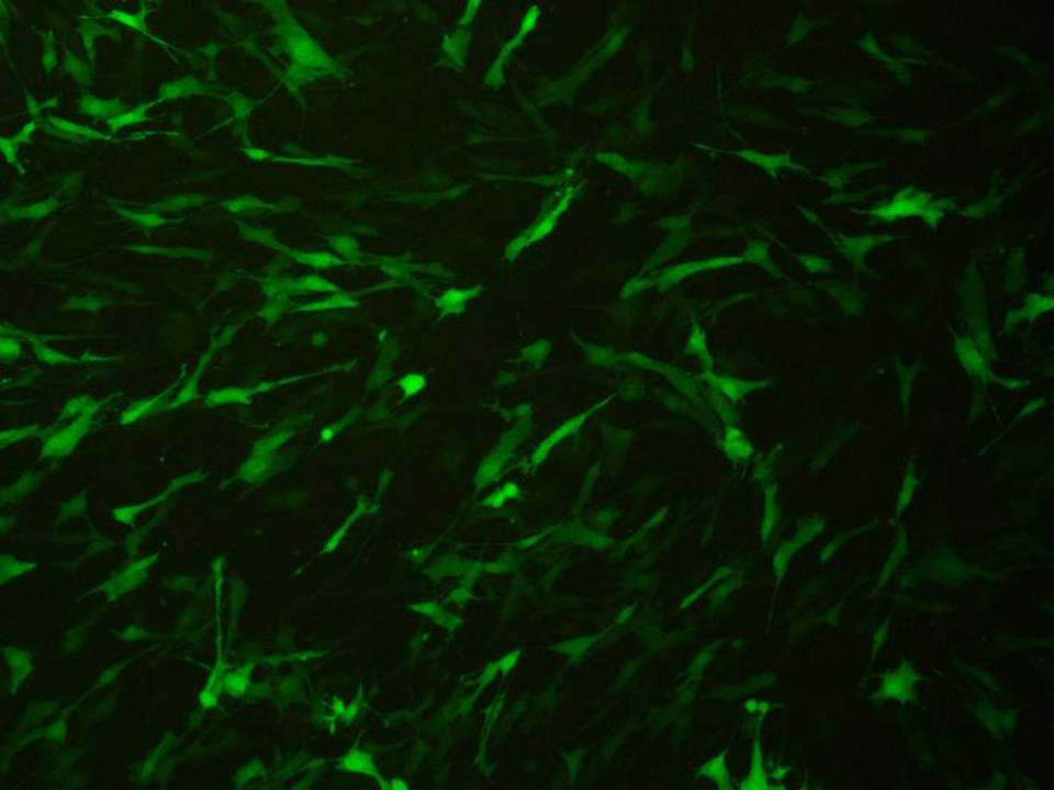Primary - Human Mesenchymal Stem cells - Transfection Efficiency 75 per cent